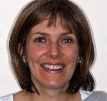 Smile Gallery - Church Road Dental and Cosmetic