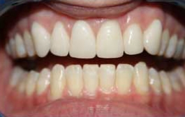 Smile Gallery - Church Road Dental and Cosmetic