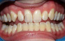 Smile Gallery - Church Road Dental and Cosmetic