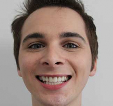 Smile Gallery - Church Road Dental and Cosmetic