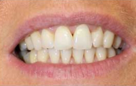 Smile Gallery - Church Road Dental and Cosmetic