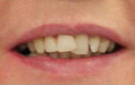 Smile Gallery - Church Road Dental and Cosmetic