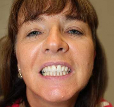 Smile Gallery - Church Road Dental and Cosmetic
