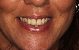 Smile Gallery - Church Road Dental and Cosmetic