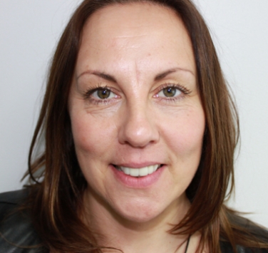 Smile Gallery - Church Road Dental and Cosmetic