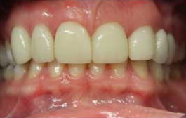 Smile Gallery - Church Road Dental and Cosmetic