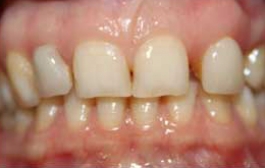 Smile Gallery - Church Road Dental and Cosmetic
