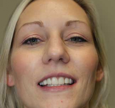 Smile Gallery - Church Road Dental and Cosmetic