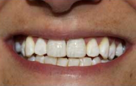 Smile Gallery - Church Road Dental and Cosmetic