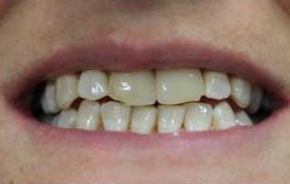 Smile Gallery - Church Road Dental and Cosmetic