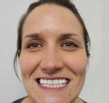 Smile Gallery - Church Road Dental and Cosmetic