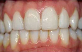 Smile Gallery - Church Road Dental and Cosmetic