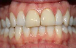 Smile Gallery - Church Road Dental and Cosmetic