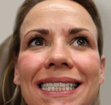 Smile Gallery - Church Road Dental and Cosmetic