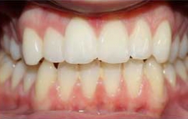 Smile Gallery - Church Road Dental and Cosmetic