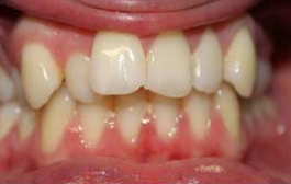 Smile Gallery - Church Road Dental and Cosmetic