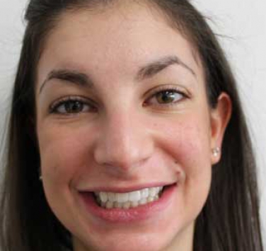Smile Gallery - Church Road Dental and Cosmetic