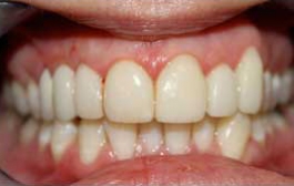 Smile Gallery - Church Road Dental and Cosmetic