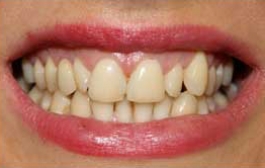 Smile Gallery - Church Road Dental and Cosmetic