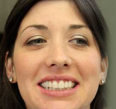 Smile Gallery - Church Road Dental and Cosmetic