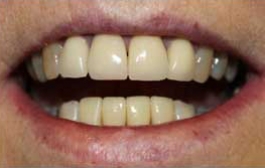 Smile Gallery - Church Road Dental and Cosmetic