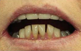 Smile Gallery - Church Road Dental and Cosmetic