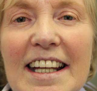 Smile Gallery - Church Road Dental and Cosmetic