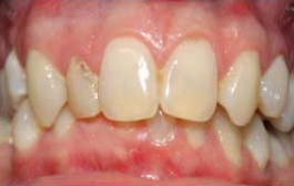 Smile Gallery - Church Road Dental and Cosmetic