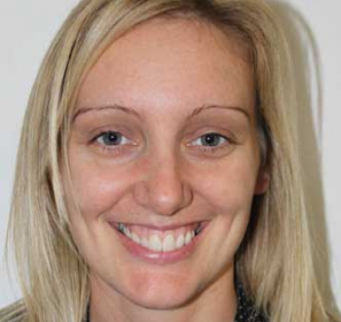 Smile Gallery - Church Road Dental and Cosmetic