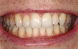 Smile Gallery - Church Road Dental and Cosmetic