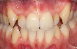 Smile Gallery - Church Road Dental and Cosmetic