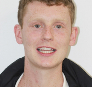 Smile Gallery - Church Road Dental and Cosmetic