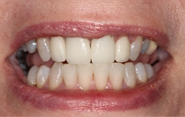 Smile Gallery - Church Road Dental and Cosmetic