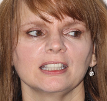 Smile Gallery - Church Road Dental and Cosmetic