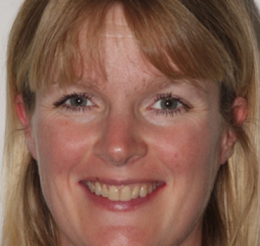 Smile Gallery - Church Road Dental and Cosmetic