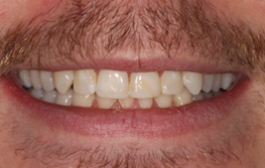 Smile Gallery - Church Road Dental and Cosmetic