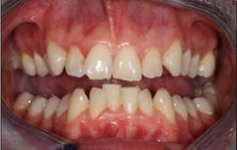 Smile Gallery - Church Road Dental and Cosmetic