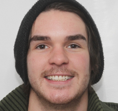 Smile Gallery - Church Road Dental and Cosmetic