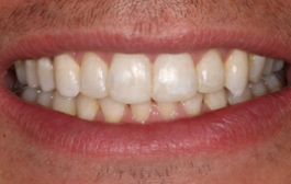 Smile Gallery - Church Road Dental and Cosmetic
