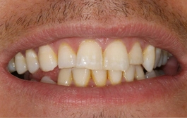 Smile Gallery - Church Road Dental and Cosmetic
