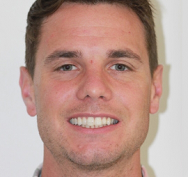 Smile Gallery - Church Road Dental and Cosmetic