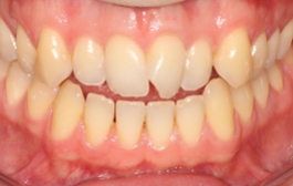 Smile Gallery - Church Road Dental and Cosmetic
