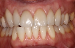 Smile Gallery - Church Road Dental and Cosmetic