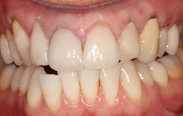 Smile Gallery - Church Road Dental and Cosmetic