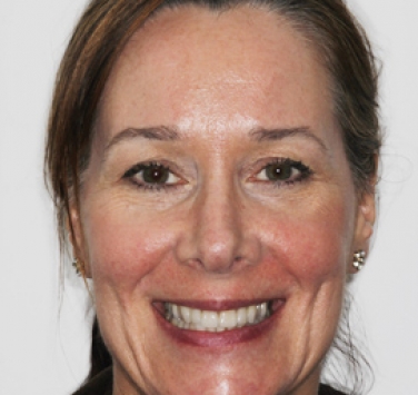 Smile Gallery - Church Road Dental and Cosmetic