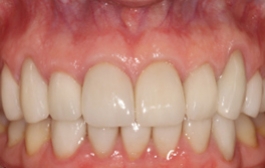Smile Gallery - Church Road Dental and Cosmetic