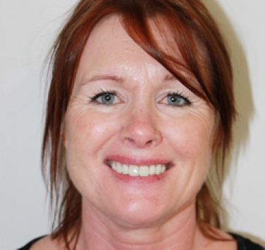 Smile Gallery - Church Road Dental and Cosmetic