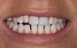 Smile Gallery - Church Road Dental and Cosmetic