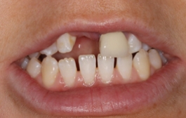 Smile Gallery - Church Road Dental and Cosmetic