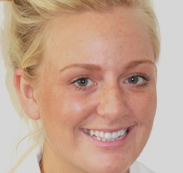 Smile Gallery - Church Road Dental and Cosmetic